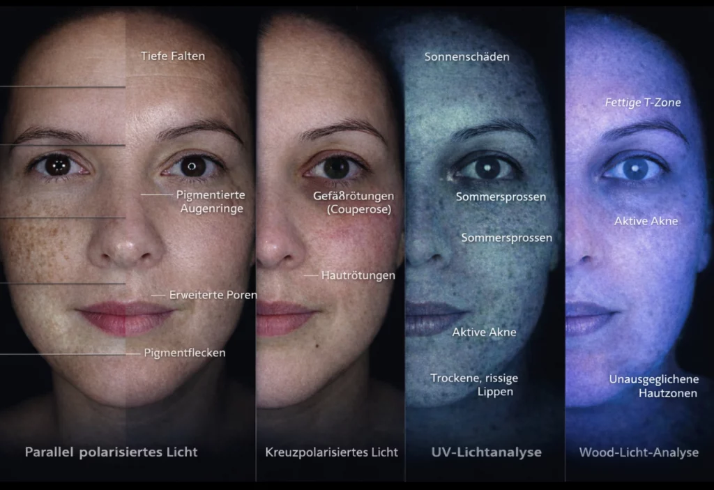 3D Hautanalyse Dresden