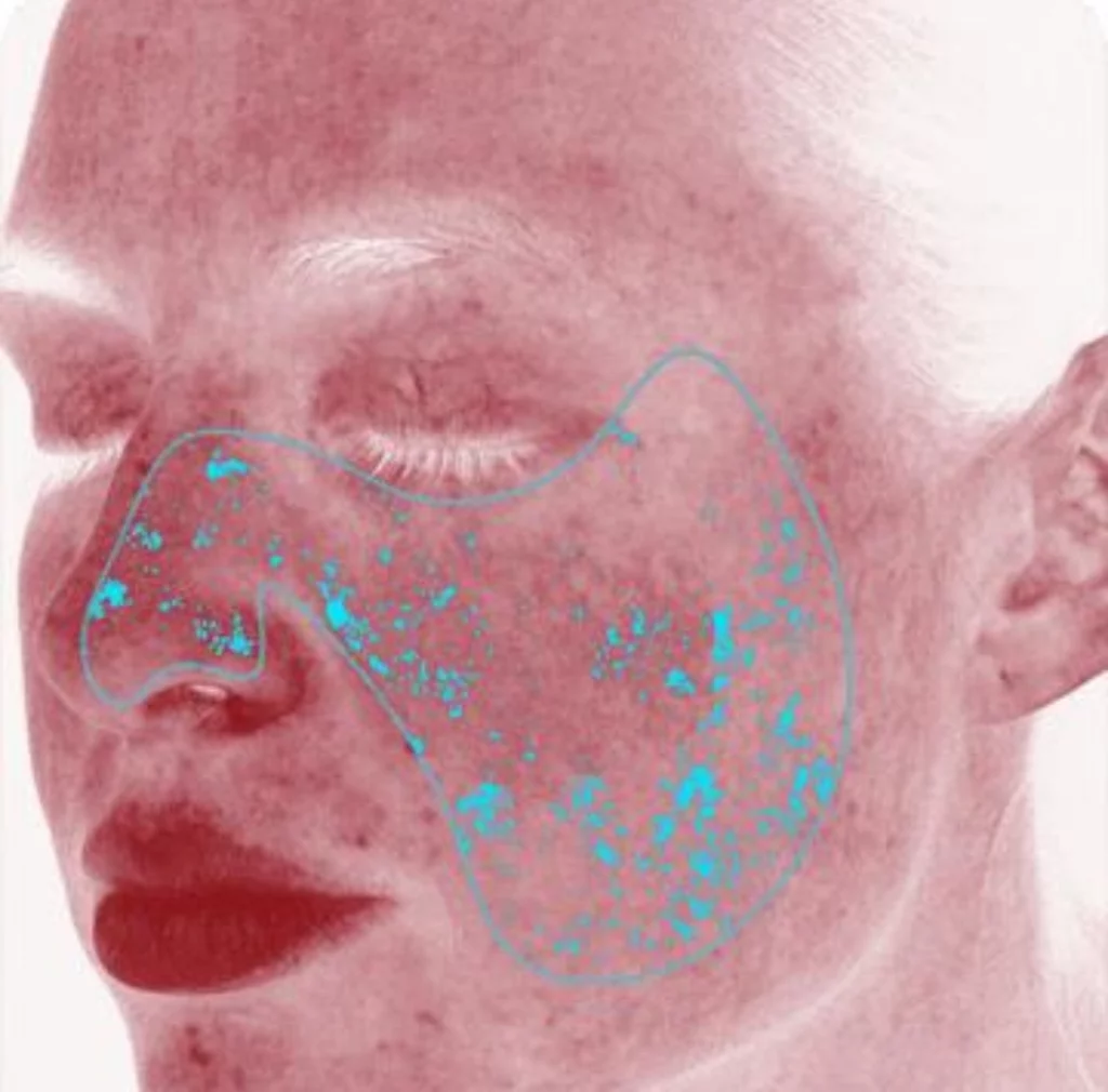 3D Hautanalyse Dresden