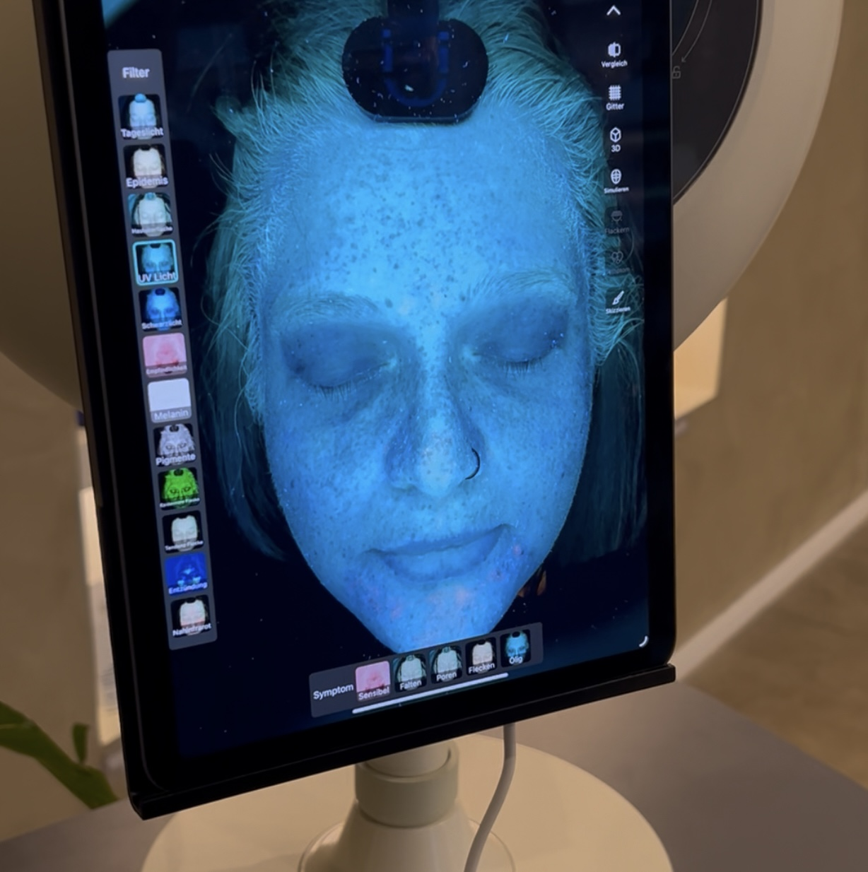 3D Hautanalyse Dresden