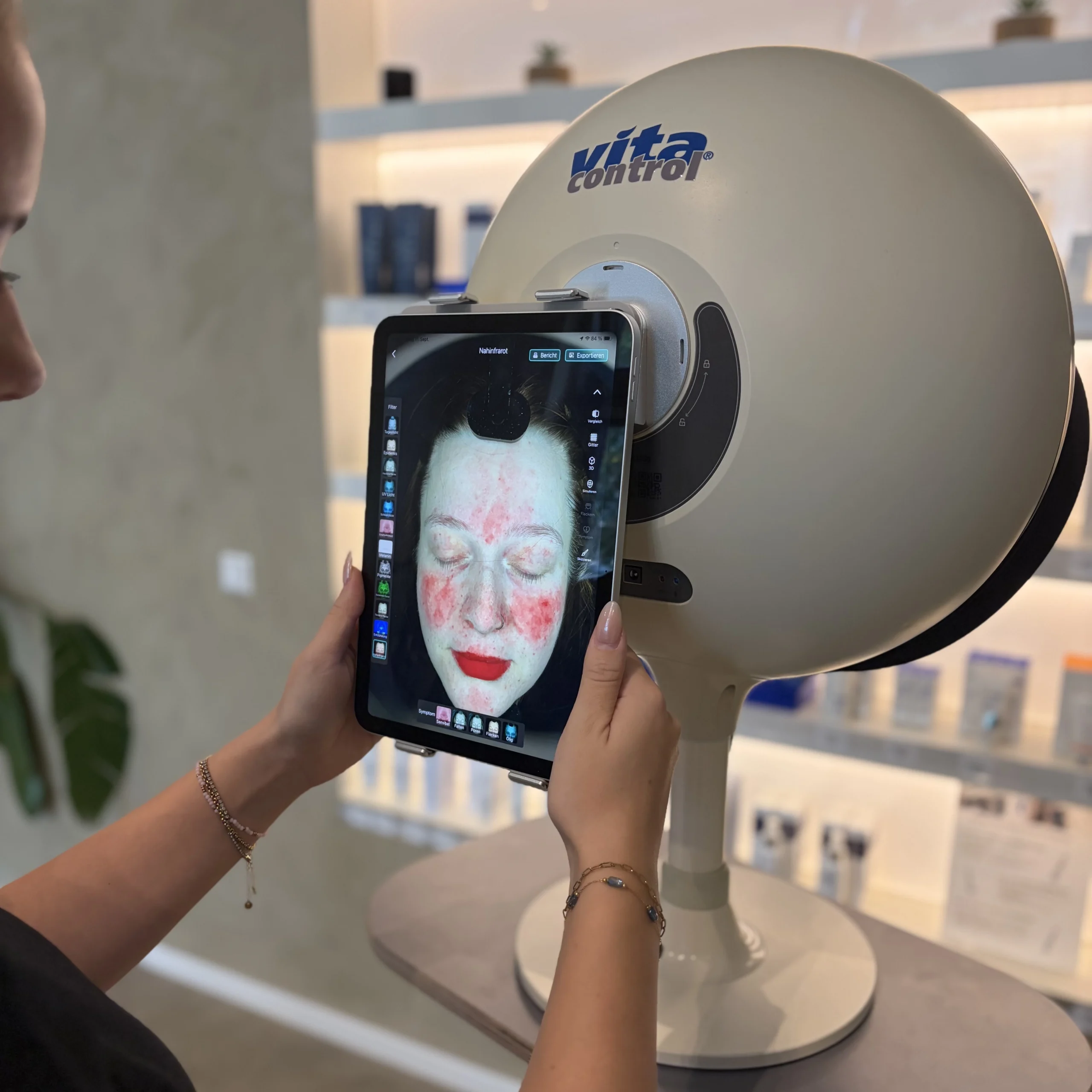 3D Hautanalyse Dresden
